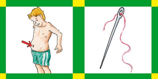 [80324] Minimix 2 - Artikulationsort