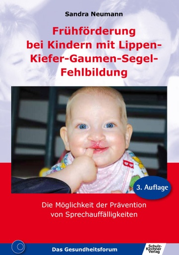 [873130] LKGS Lippen-Kiefer-Gaumen-Segel-Fehlbildung E-Book