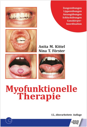 [874080] Myofunktionelle Therapie E-Book